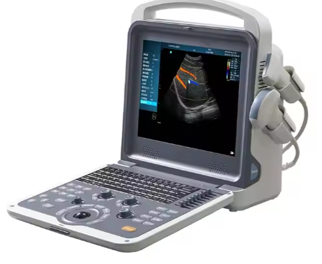 Medical 4D Upgradable Laptop Color Doppler Portable Ultrasound Scanner Machine with 2 Probes