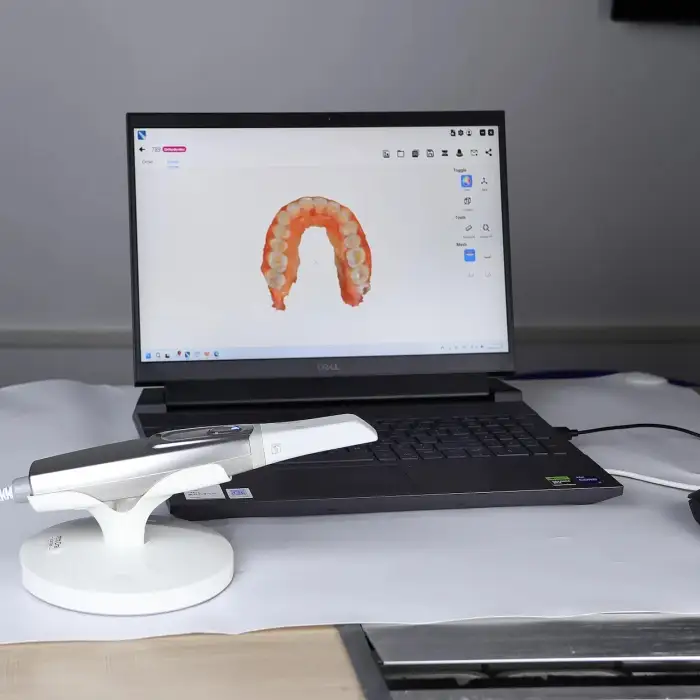 Digital Dentist 3D Scan Intra Oral Camera Dental Equipment Dental 3D Intraoral Scanner