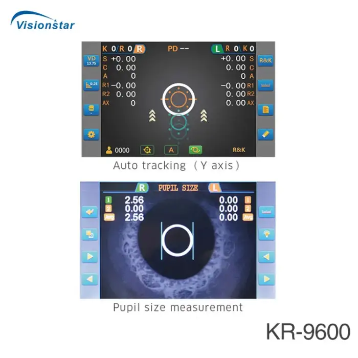 KR-9600 Autorefractometer and Keratometer for Advanced Ophthalmic Measurements