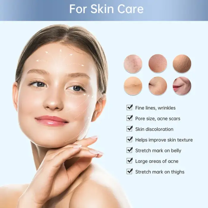 RF SKIN TIGHTENING MICRONEEDLING MACHINE: RF MICRONEEDLING DEVICE FOR HOME USE