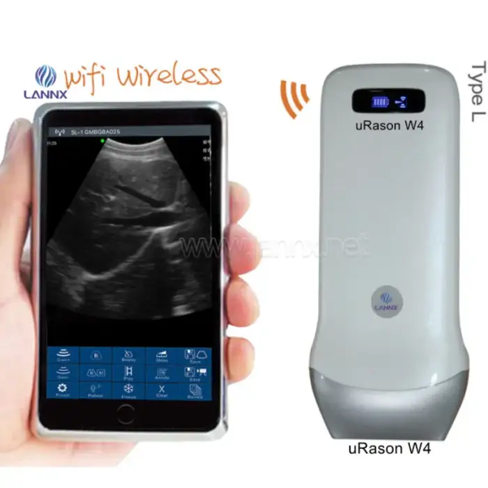 LANNX uRason W4 Hospital Use Lear Image Wireless Ultrasound Pregnancy Probe Scanner Black and White Wireless Linear Probe USG