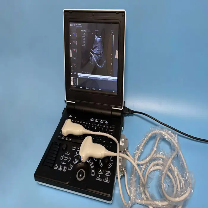 EGRETMED laptop color ultrasound machine with convex probe Model: MSLCU02