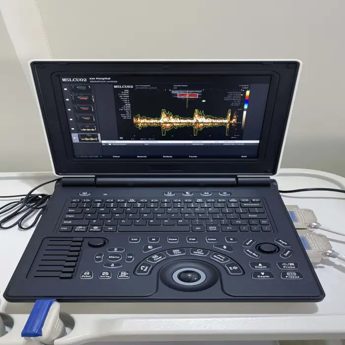 EGRETMED laptop color ultrasound machine with convex probe Model: MSLCU02