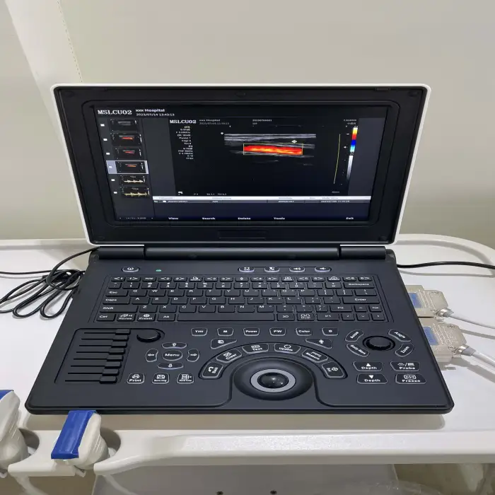 EGRETMED laptop color ultrasound machine with convex probe Model: MSLCU02