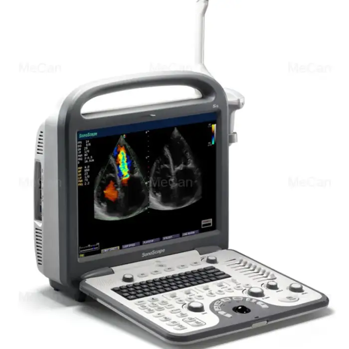 Medical Ultrasound Instruments Portable 4D Scanner Echocardiography Vascular Imaging Device