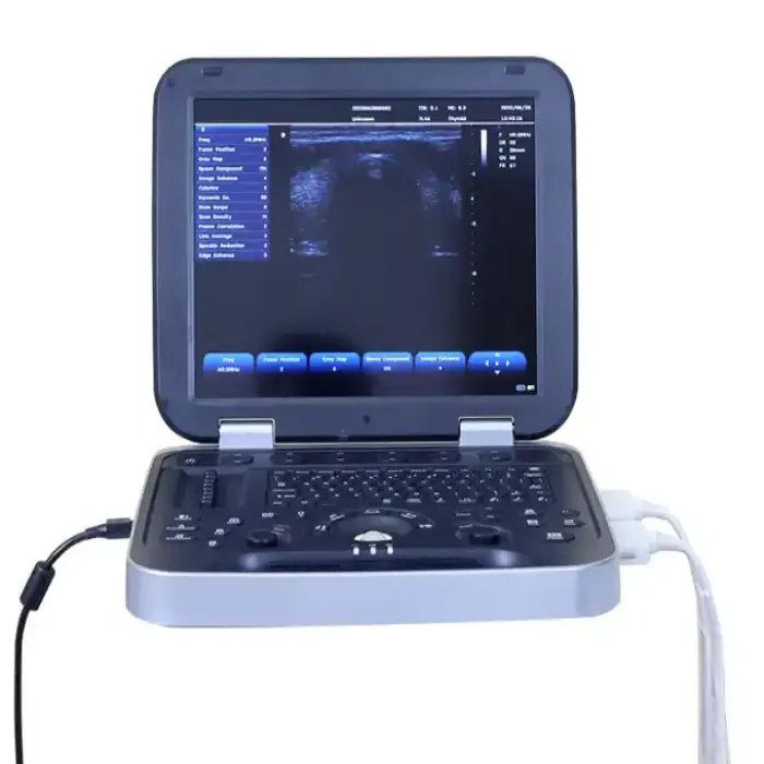 Periodmed Medical Equipment Ultrasound Machines Abdominal Machine Cardiology Colour Transvaginal Scan Ultrasound