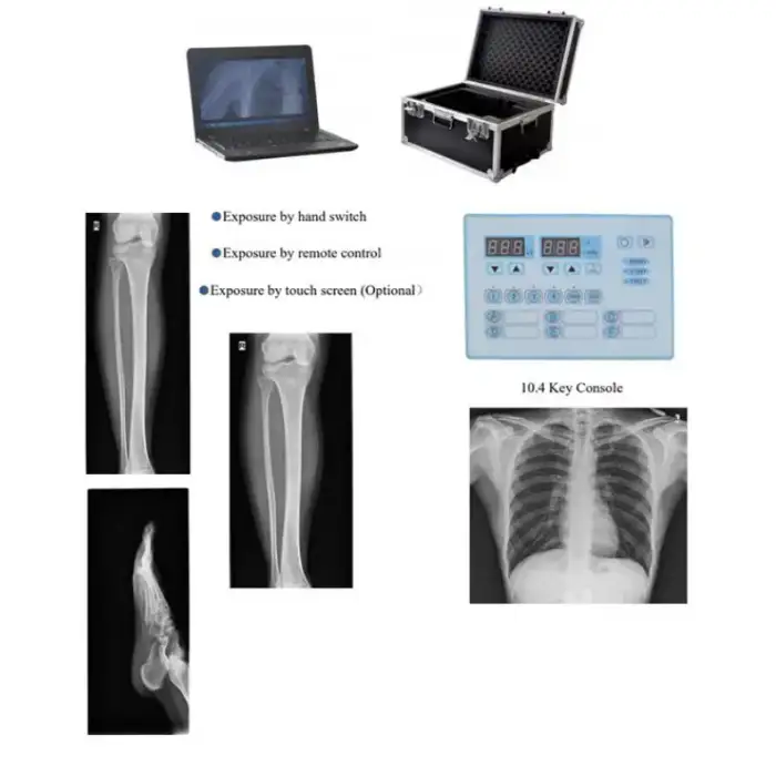 Medical Radiography X-ray Machine High Frequency Portable X ray Medical Device