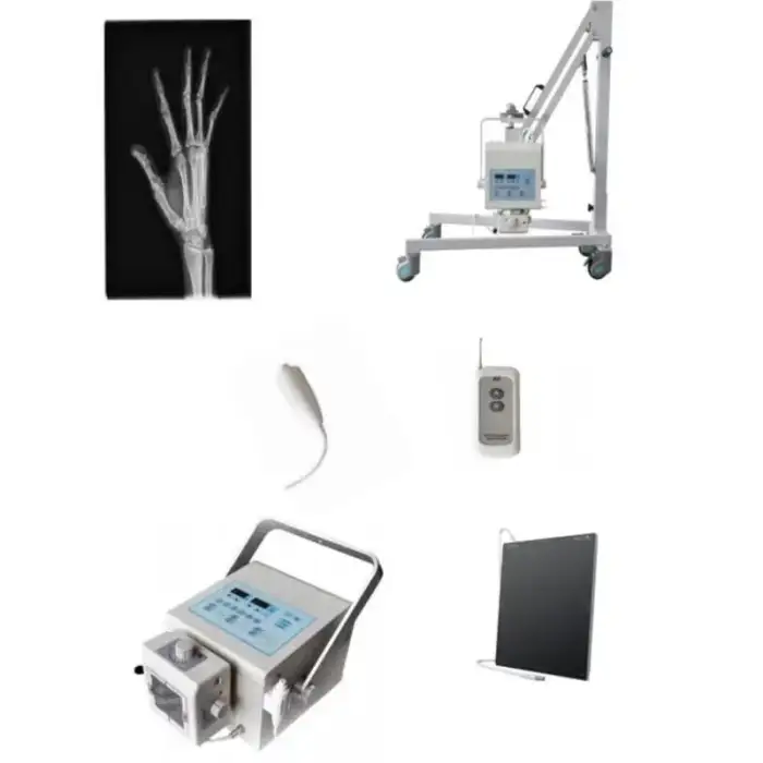 Medical Radiography X-ray Machine High Frequency Portable X ray Medical Device