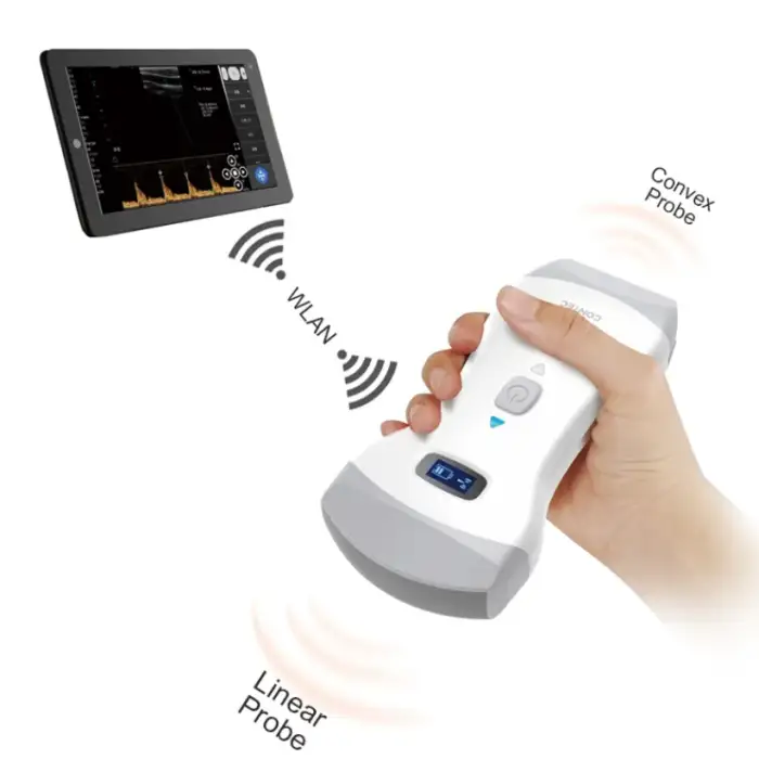 Color Doppler Ultrasound Diagnostic Machine CMS1600B