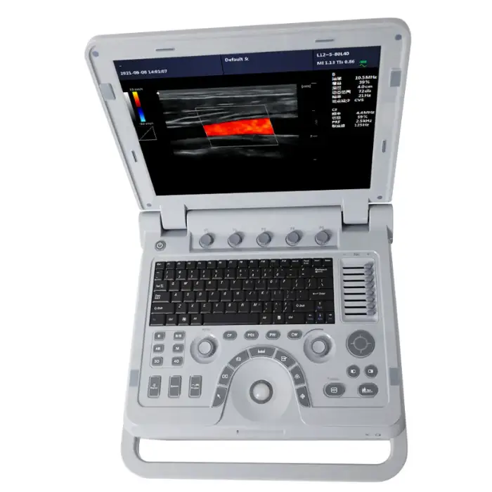 CONTEC CMS1700B abdominal obstetric urology cardiac pediatric gynecology peripheral vascular ultrasound color doppler