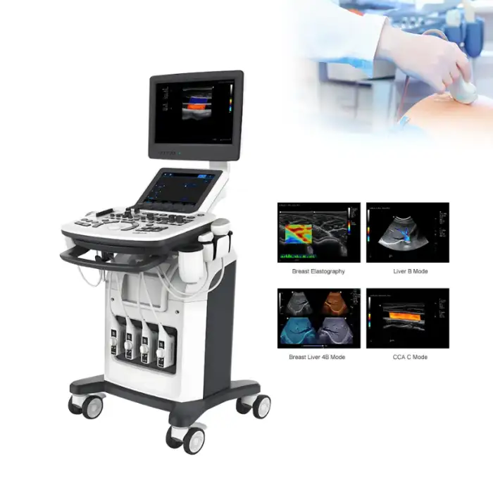 Medical veterinary ultrasound machine for vet pregnancy scan