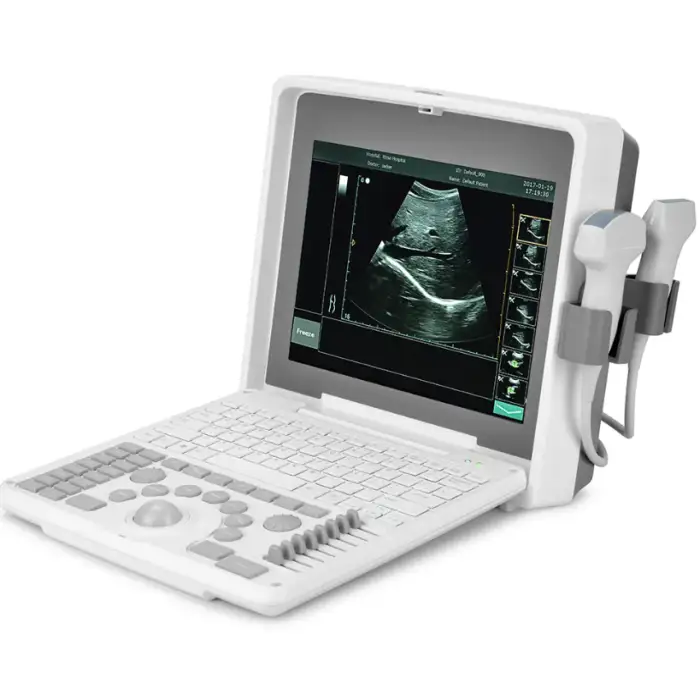 Hospital Diagnostic Ultrasound Medical Veterinary Portable Machine