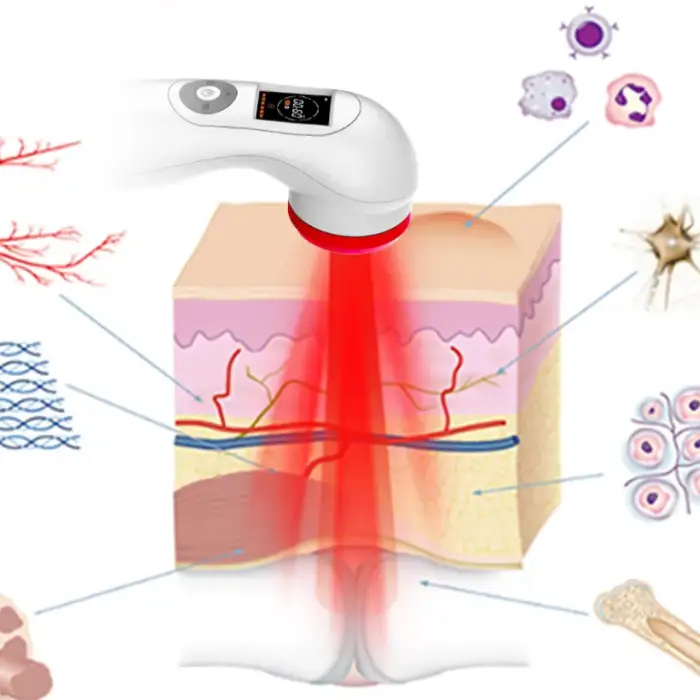 Veterinary Physiotherapy Equipment Class 4 Laser Therapy Lllt Treatment Device For Back Pain Relief Wound Healing