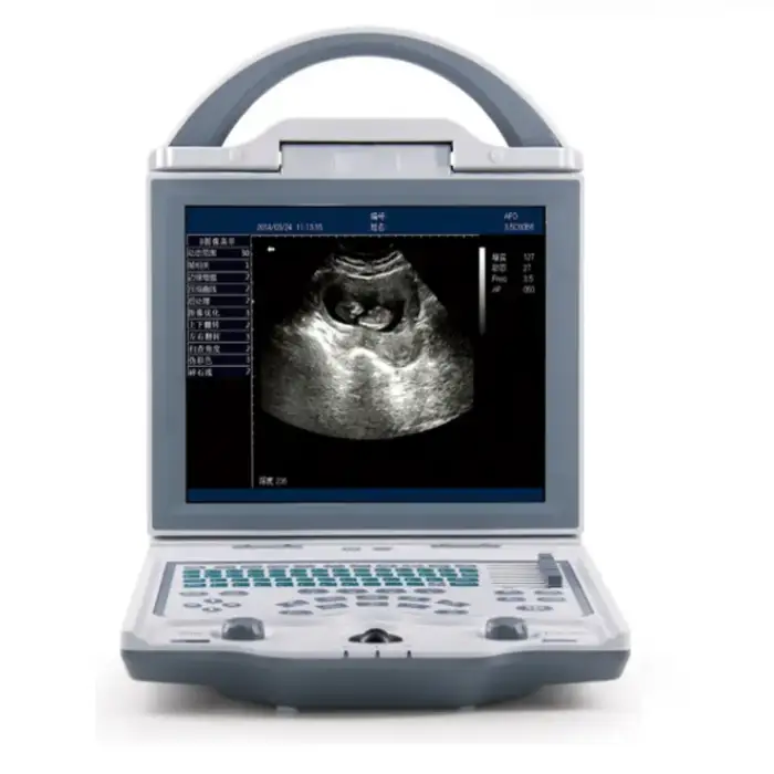 Portable Ultrasound Machine Medical Equipment Gray Scale Ultrasound Vet Ultra Skin Power Supply Hospital Equipment