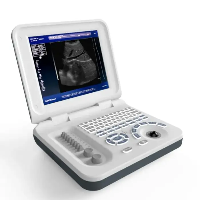 Portable Ultrasound Machine For Veterinary Use