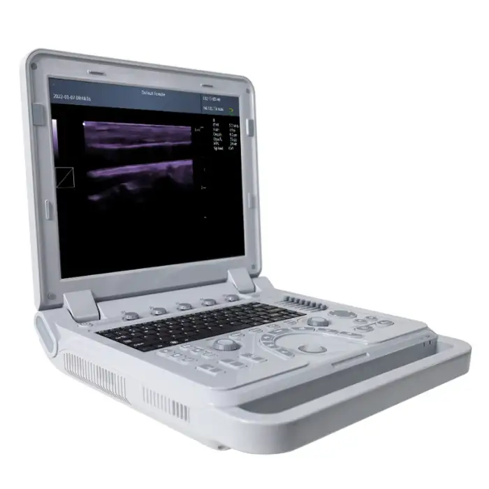 Portable Ultrasound Diagnostic System CMS600P2PLUS