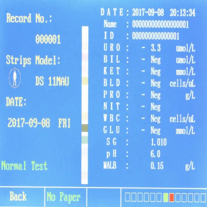 W-600 Laboratory Biochemistry Urine Test Analyzer