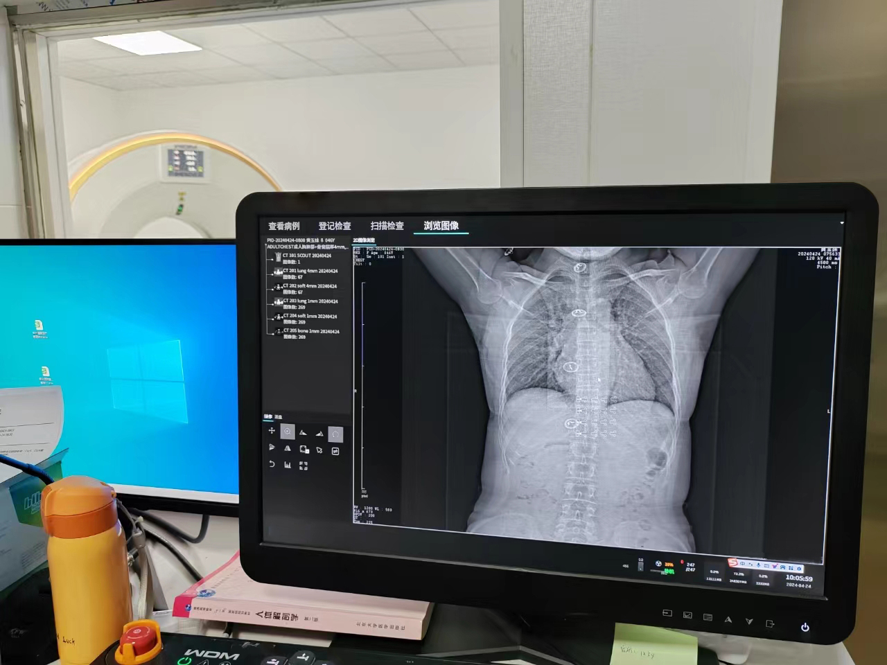 16 32 64 128 256 Slice Spiral CT X-ray Machine with Cardiac Scanner