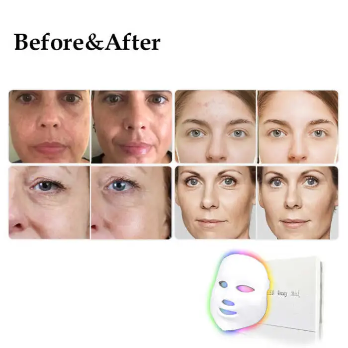 Anti Aging Face and Neck Led Mask Medical Grade 630nm Red Led 3 Color Facial Therapy Mask