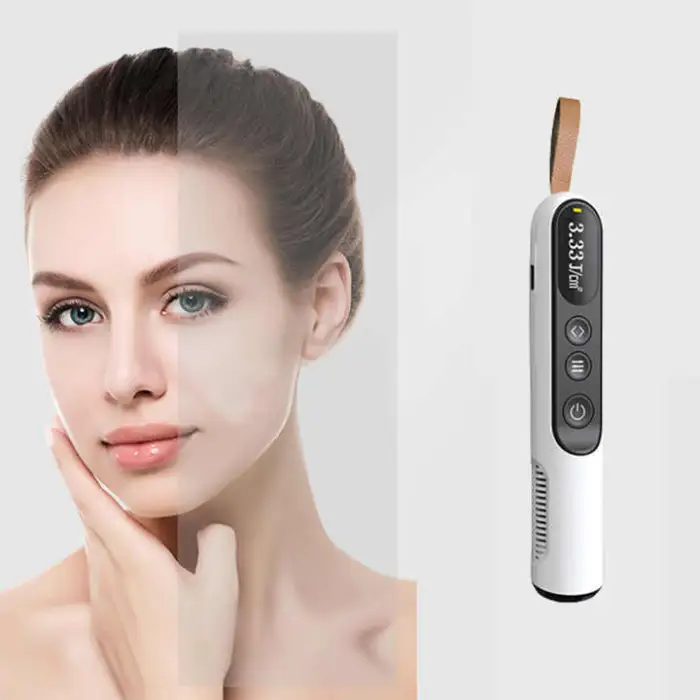 LED 308nm Handheld UVB Lamp Phototherapy for Vitiligo Psoriasis Treatment