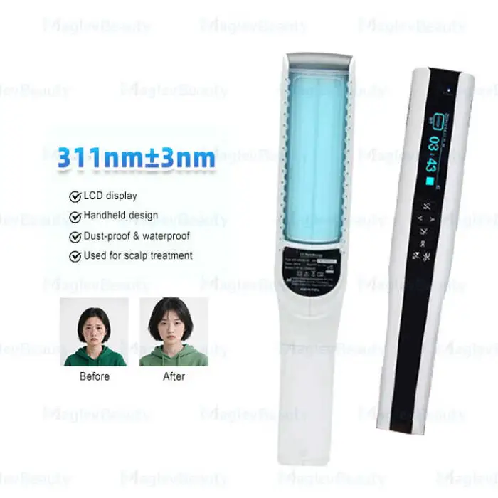 Medical  Home Use Handheld 311nm UVB Lamp 308nm Phototherapy Device 308 UVB for Vitiligo Psoriasis Eczema Treatment