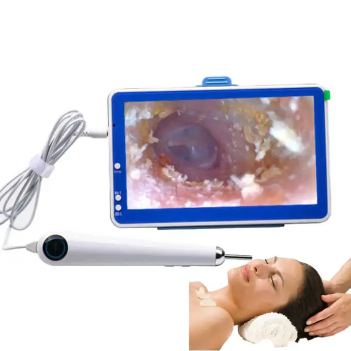 7 Inch Visible Otoscope 3.9mm Ear Cleaning Endoscope ENT Endoscopy Visual Ear Spoon Medical Ear Endoscope Camera