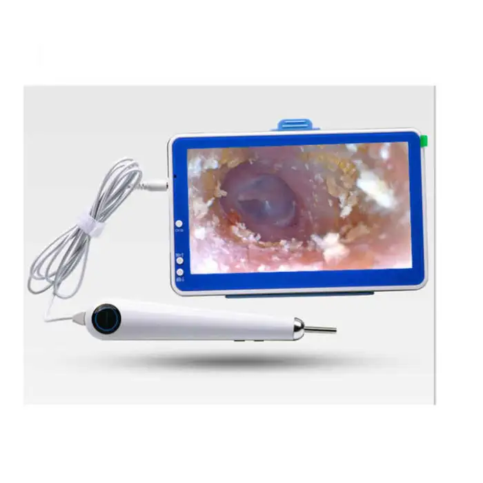 7 Inch Visible Otoscope 3.9mm Ear Cleaning Endoscope ENT Endoscopy Visual Ear Spoon Medical Ear Endoscope Camera