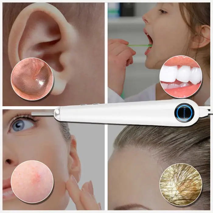 7 Inch Visible Otoscope 3.9mm Ear Cleaning Endoscope ENT Endoscopy Visual Ear Spoon Medical Ear Endoscope Camera
