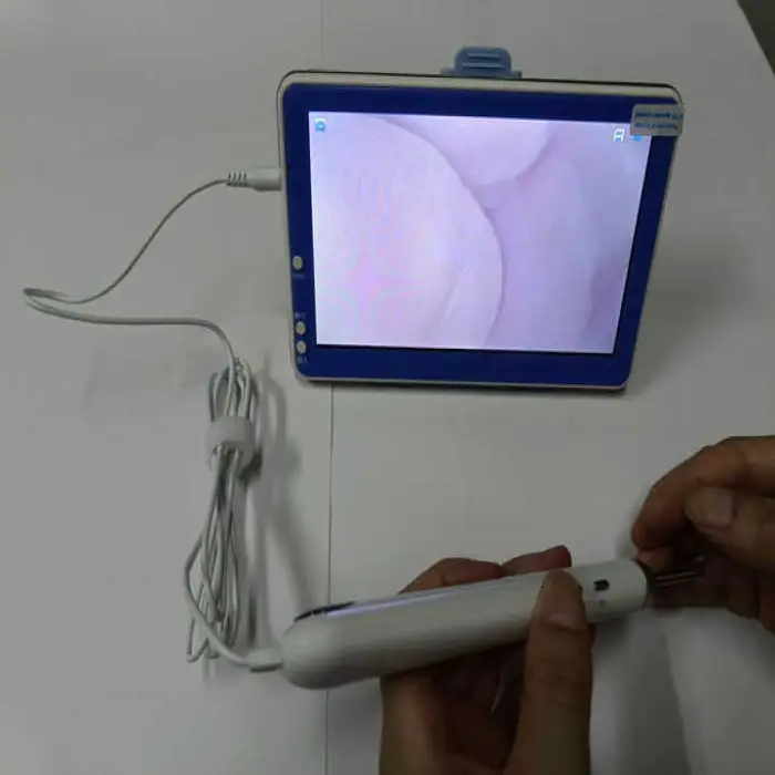 7 Inch Visible Otoscope 3.9mm Ear Cleaning Endoscope ENT Endoscopy Visual Ear Spoon Medical Ear Endoscope Camera