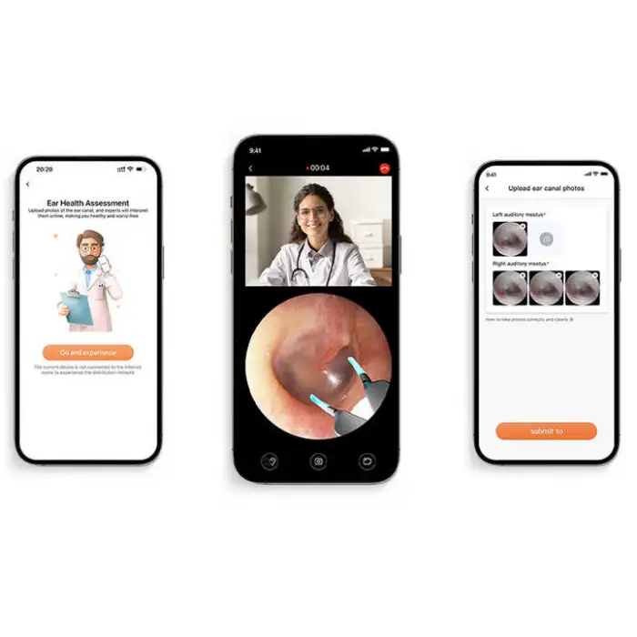 H30S Smart Home Product AI Ear Health Assistant Smart Household Appliances for Ear Cleaning