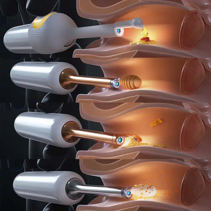 H30S Smart Home Product AI Ear Health Assistant Smart Household Appliances for Ear Cleaning