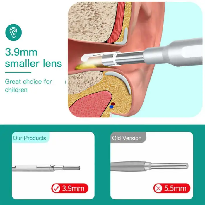 Rechargeable Ear Cleaner Smart Otoscope Earwax Suction Camera Earpick Ear Wax Removal Kit Camera Ear Cleaner