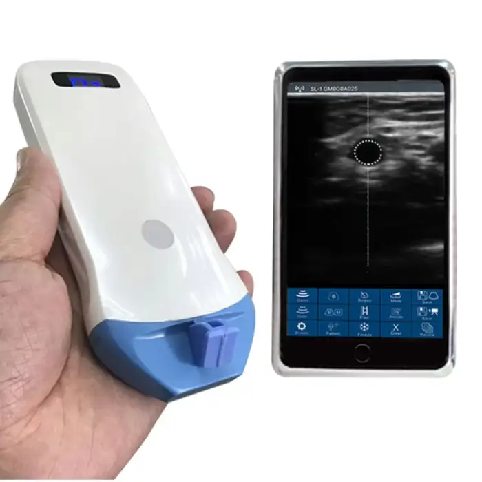 Clinic Use B/W 128 Elements Linear Probe Wireless Ultrasound Scanner Machine Available Skin Detector