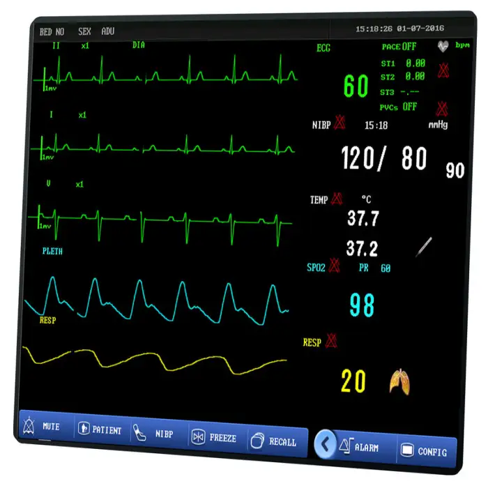 Electric Multi-Parameter Patient Monitor Medical Device Equipment Made of Durable Metal