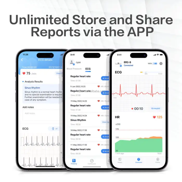 Pocket ECG Monitor Ai Analysis Unlimited Storage and Share Report Wireless ECG Holter Monitor EKG