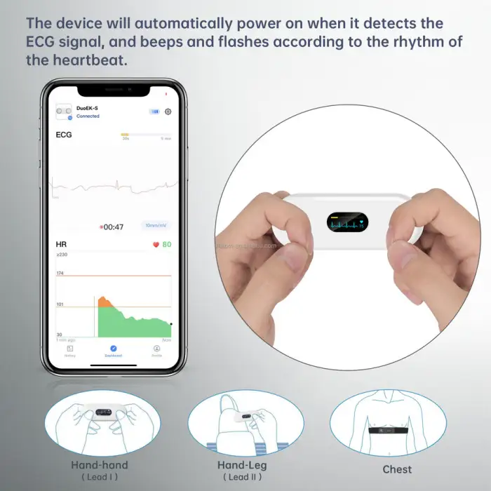 Pocket ECG Monitor Ai Analysis Unlimited Storage and Share Report Wireless ECG Holter Monitor EKG