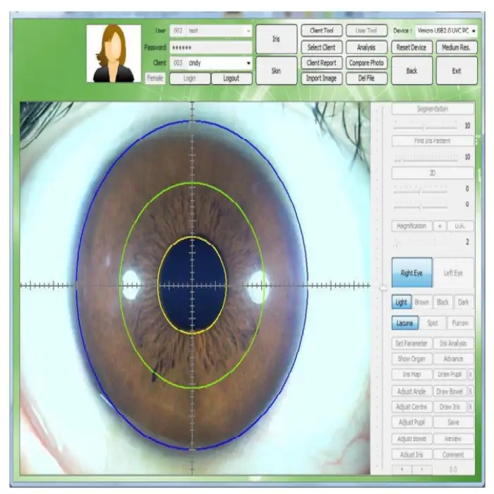 Iris Hair Skin Tester With High Magnification Optional Lens Healthcare