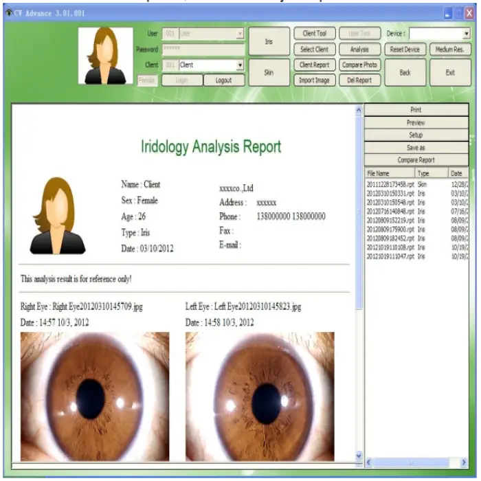 Iris Hair Skin Tester With High Magnification Optional Lens Healthcare