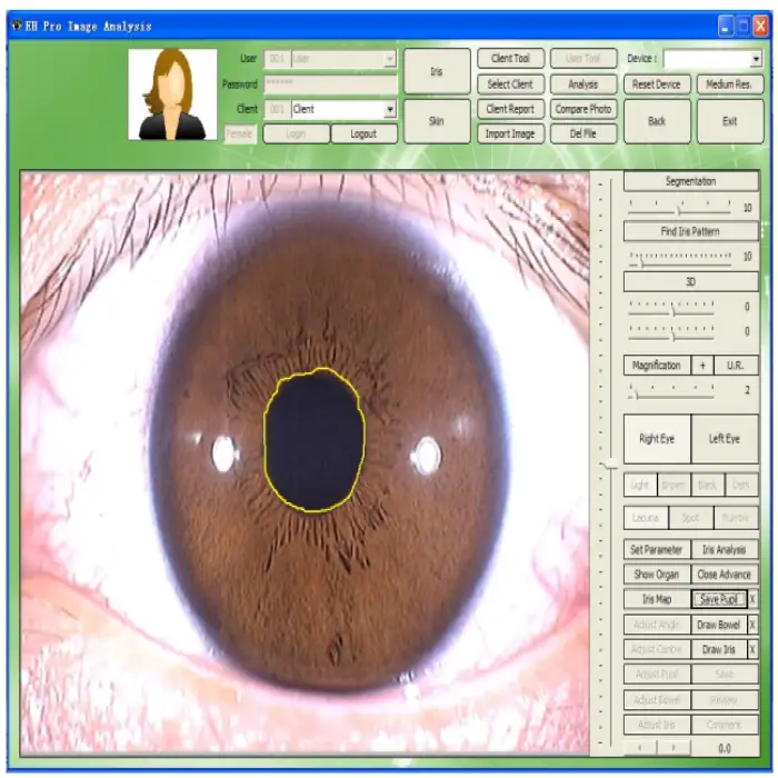 Iris Hair Skin Tester With High Magnification Optional Lens Healthcare