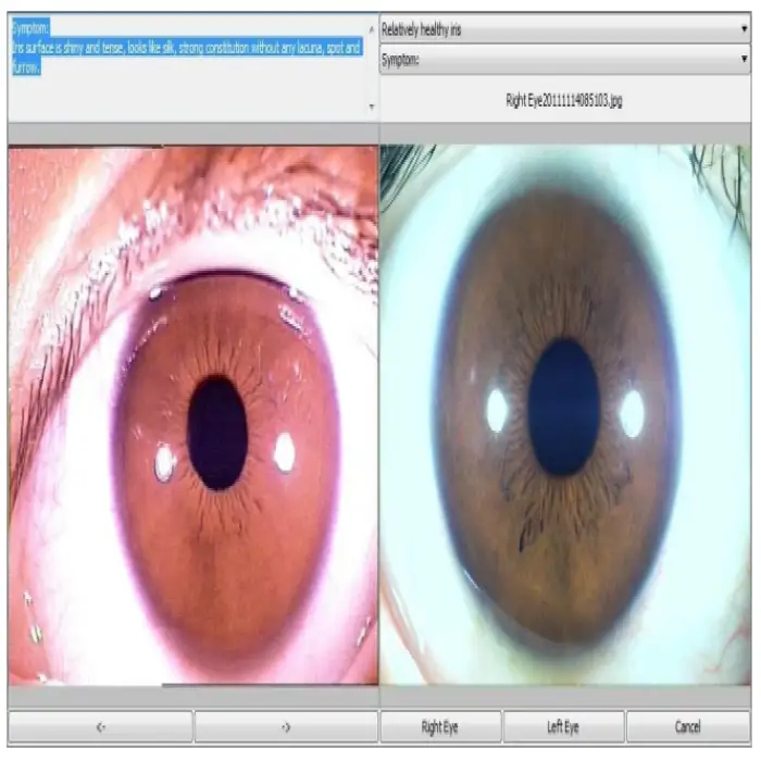 Iris Hair Skin Tester With High Magnification Optional Lens Healthcare