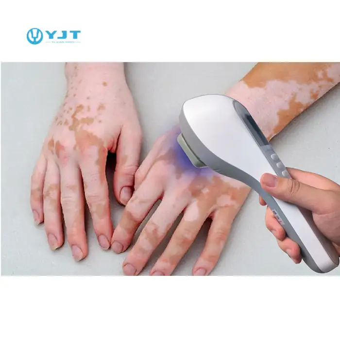 Clinic Use Portable Handheld 308nm Led Uvb Phototherapy for Vitiligo Treatment Phototherapy for Skin Diseases Treatment