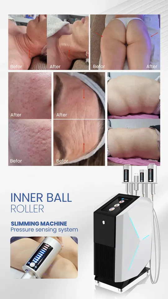 9D Weight Loss Skin Tightening Cellulite Reduction Inner Ball Roller Body Shaping Massage Machine — image 5