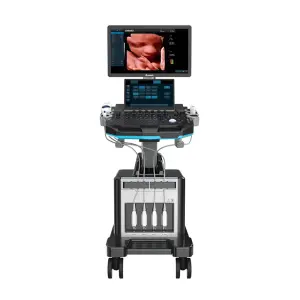 MN-Ultra7 Professional Ultrasound Machine
