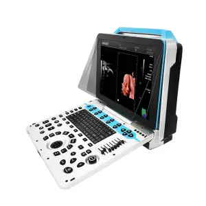 Portable HD 3D/4D/5D Real Skin Color OB GYN Ultrasound Instrument