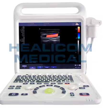 Advanced Portable Ultrasound Scanner Diagnostic Instrument