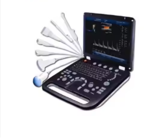 medical equipment large Screen Diagnostic Ultrasound machine Trolley Color Doppler Ultrasound Scan