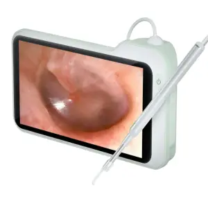 Rechargeable Ear Cleaner Smart Otoscope Earwax Suction Camera Earpick Ear Wax Removal Kit Camera Ear Cleaner