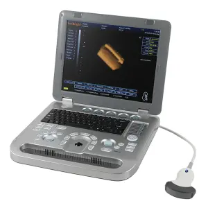 Clinic Hospital Laptop Ultrasound 3D Color Display Ultrasound Machine SUN-800D