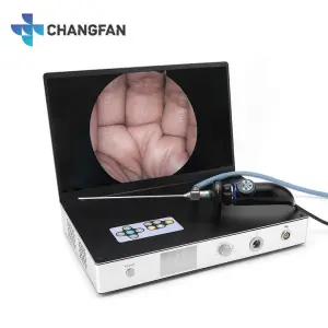 Medical Endoscope Camera System 15.6 Inch Portable Endoscope Camera 4 in 1 Integrated Medical Camera System Full HD