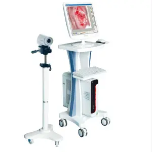 High Performance Digital Video Colposcope for Gynecology With Trolley Video Colposcopio Digital Portatil Ginecologia
